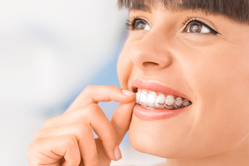 Invisalign in Brooksville