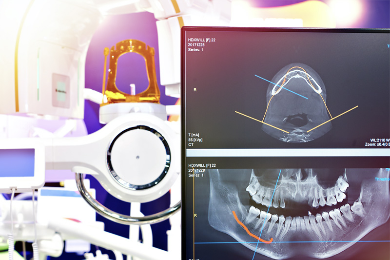 Digital X-Rays in Brooksville